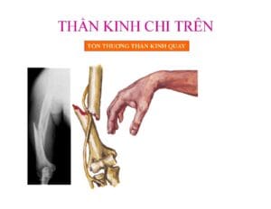thần kinh chi trên