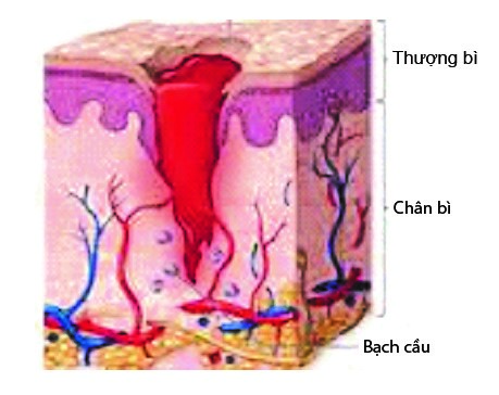 mô tế bào giai đoạn viêm - lành vết thương 