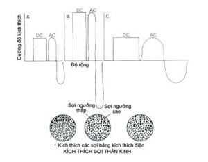 Kích thích sợi thần kinh