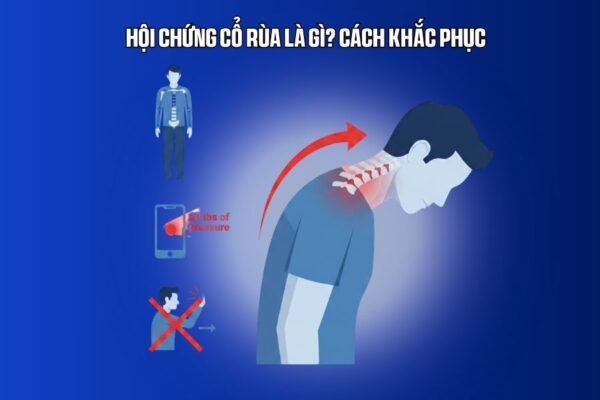 Hội chứng cổ rùa là gì cách khắc phục nguyên nhân gây ra Cách hạn chế và phòng tránh hội chứng cổ rùa Tư thế khi ngồi khi làm việc với máy tính Tư thế khi lái xe Sử dụng thuốc để giảm cơn đau tức thời? Các bài tập giúp giảm, điều trị hội chứng cổ rùa