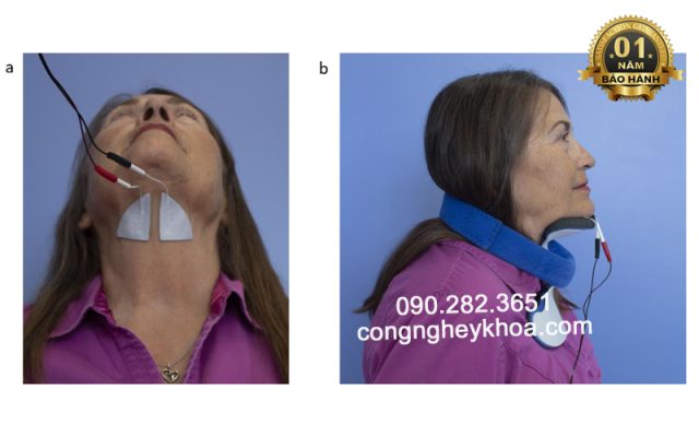 Dán điện cực Ampcare Esp để điều trị rối loạn nuốt ở giai đoạn hầu họng