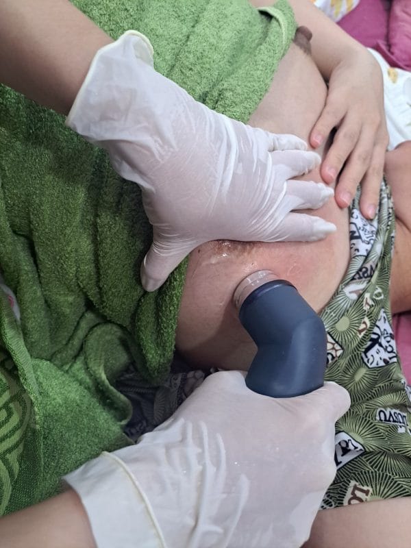 Tìm hiểu về máy siêu âm thông tắc sữa