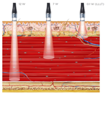 Mức độ xuyên sâu khác nhau ở mức cường độ laser khác nhau trong máy laser công suất cao luxmaster