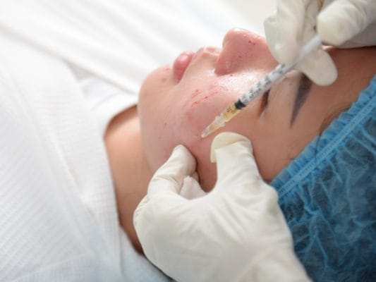 Huyết tương PRP đảm bảo an toàn khi sử dụng