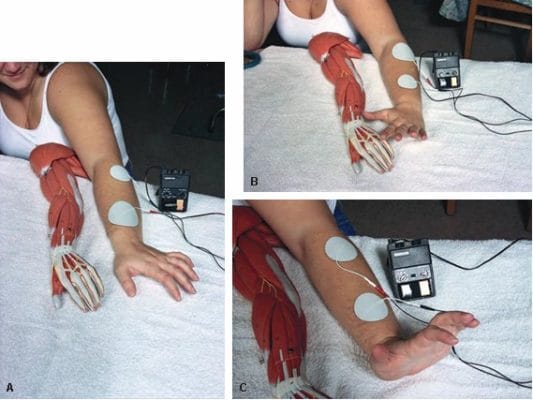 Máy xung điện trị liệu có tác dụng gì