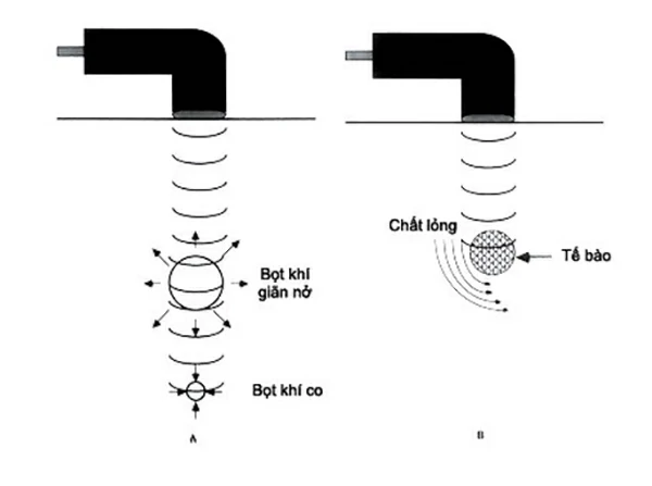 Vật lý trị liệu bằng phương pháp siêu âm trị liệu