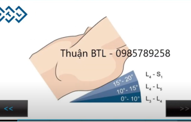 các góc kéo lưng khác nhau sẽ tác động vào các đốt sống thắt lưng khác nhau trong phương pháp kéo cột sống cổ lưng