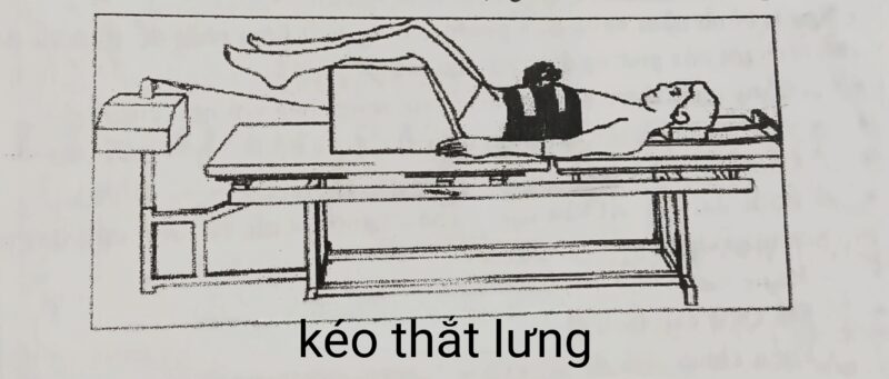 Minh họa kéo thắt lưng trong kéo cột sống cổ lưng