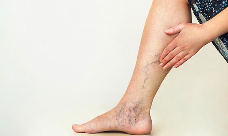 Những ai nên dùng máy nén ép trị liệu?