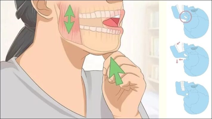 Trị viêm khớp thái dương hàm bằng vật lý trị liệu