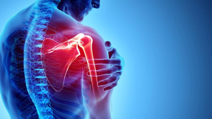 trị đau vai bằng vật lý trị liệu