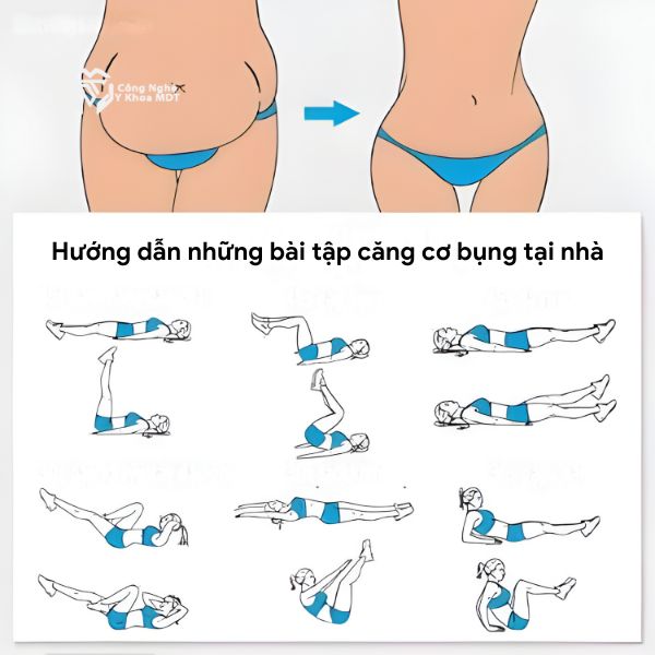 Hướng dẫn những bài tập căng cơ bụng tại nhà dành cho nam và nữ 