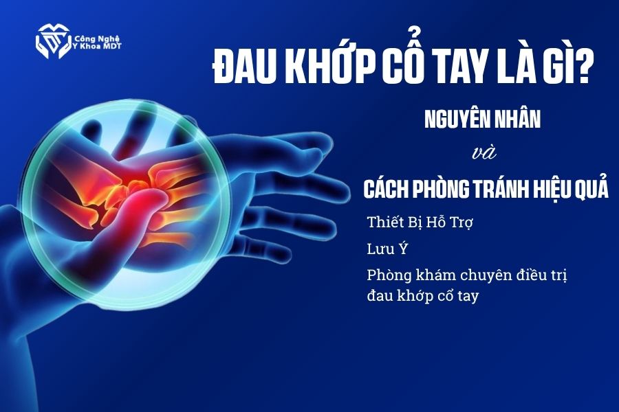 Đau Khớp Cổ Tay Là GìNguyên Nhân và Cách Phòng Tránh Hiệu Quả