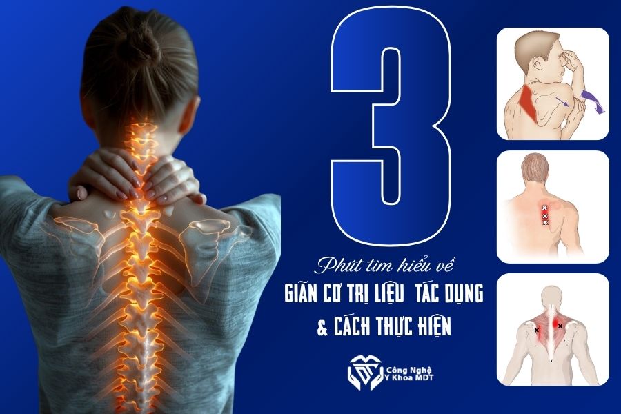 Giãn Cơ Trị Liệu Là Gì Tác Dụng & Cách Thực Hiện Hiệu Quả Trong Vật Lý Trị Liệu 2026