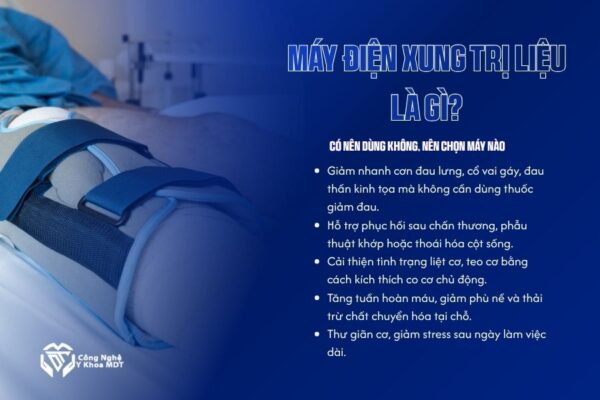 Máy điện xung trị liệu là gì Có nên dùng không, nên chọn máy nào