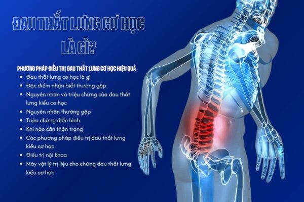 Phương pháp điều trị đau thắt lưng cơ học hiệu quả