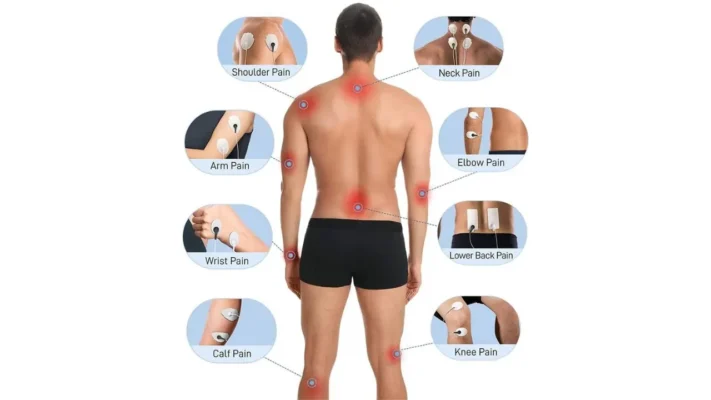Các vùng đau có thể được hỗ trợ bằng điện xung